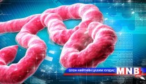 Эбола цусархаг халууралт өвчний тухай