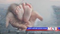 Ургийн гажигтай хүүхэд мэндлэх нь ихэсчээ
