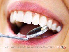 Шүдний өвчлөлийн шалтгаан чихэрлэг бүтээгдэхүүнтэй холбоотой