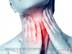 Хоолойн өвдөлтийг эмгүйгээр эмчлэх үү?