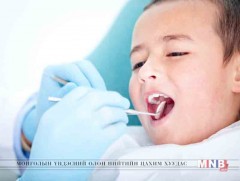 Хүүхдийн шүдний өвчлөл их байна