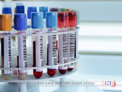 Нийслэлийн хэмжээнд 41.162 хүн хепатитийн В, С вирусын илрүүлэг шинжилгээнд хамрагджээ