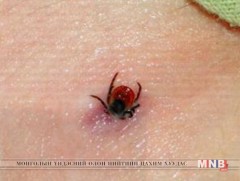 Хачигт энцефалитын хүний өвчлөл өсөх хандлагатай байна