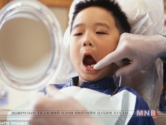 Шүдний цоорол хоол хүнсний буруу хэрэглээнээс үүдэлтэй  