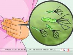 Хеликобактерийн гаралтай эмгэгийн 20-30 хувь нь хавдарт шилждэг