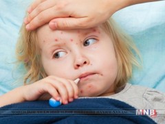 Салхинцэцэг өвчнөөс урьдчилан сэргийлэх аргууд