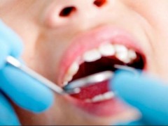 Хүүхдийн шүд өвчтэй байх нь 200 гаруй өвчний суурь болдог