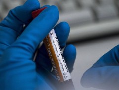 Допингийн шинжилгээний хариуг Баяр наадмыг зохион байгуулах хороонд хүргүүлсэн гэв