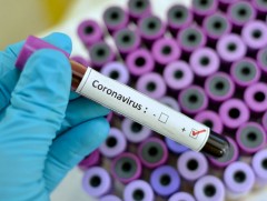 БНСУ-д коронавирусний шинжилгээ хийх эмнэлгүүдийн мэдээлэл