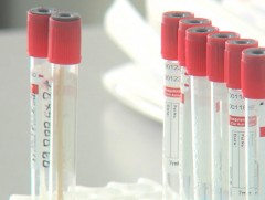 Манай улсад коронавирусний 