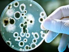 ДЭМБ: Холер, эбола зэрэг халдварт өвчин ихсэж байна 