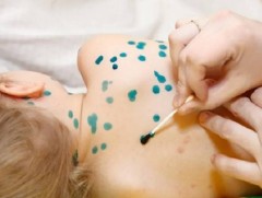 Тууралтад халдвар цэцэрлэгүүдэд голомтлон бүртгэгдэж байна