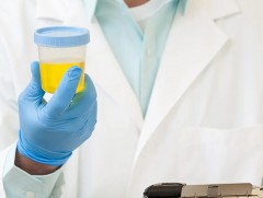 Шээсний уургийн иммунотайпинг шинжилгээний 70 хувийг ЭМД-ын сангаас хөнгөлнө