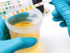 Бөөр, шээс ялгаруулах замын тодосгогчтой шинжилгээний 70 хувийг ЭМД-ын сангаас хөнгөлнө