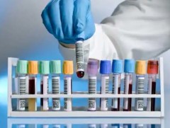 ЭМЯ: Эрт илрүүлгийг эрчимжүүлэх чиглэлээр тодорхой ажлуудыг хийлээ