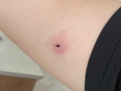 Хачигнаас биеэ хэрхэн хамгаалах вэ