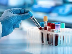 Элэг эрүүл байх нь хүн бүрийн эрүүл байх үндэс юм 