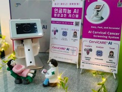 Умайн хүзүүн хорт хавдрыг таван хормын дотор хиймэл оюун ухааны тусламжтай оношилдог болно