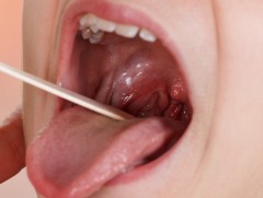 Хоолойн өвдөлтийг буруу оношилж, дур мэдэн эмчлэх нь амь насанд эрсдэлтэй