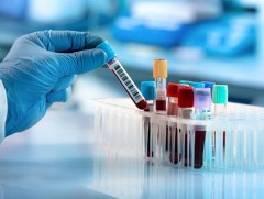 Шинжилгээний хариуг E-Mongolia-гаас хялбар авах боломжтой