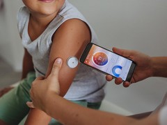 Нэгдүгээр хэв шинжийн чихрийн шижинтэй 260 хүүхдийг сенсор буюу CJM төхөөрөмжөөр хангана