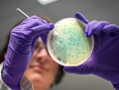 ДЭМБ: Антибиотикт тэсвэртэй өвчлөл ихсэж байна