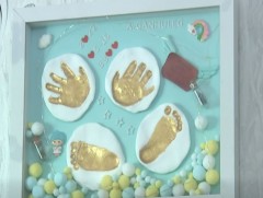 А.Ганхүлэг хүүд яаралтай цусны үүдэл эс шилжүүлэн суулгахад 600 сая төгрөг шаардлагатай гэв 